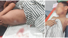 Zaki, anak 10 tahun yang menjadi korban serangan buaya di Desa Muara Bengalon, Kecamatan Bengalon, Kutai Timur, Minggu (9/11) malam lalu. 