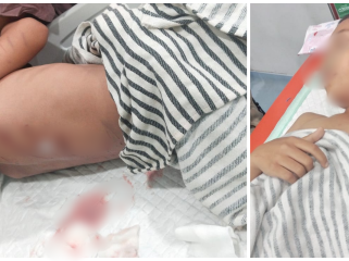 Zaki, anak 10 tahun yang menjadi korban serangan buaya di Desa Muara Bengalon, Kecamatan Bengalon, Kutai Timur, Minggu (9/11) malam lalu. 