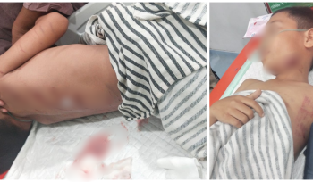 Zaki, anak 10 tahun yang menjadi korban serangan buaya di Desa Muara Bengalon, Kecamatan Bengalon, Kutai Timur, Minggu (9/11) malam lalu. 