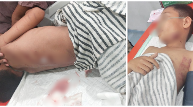 Zaki, anak 10 tahun yang menjadi korban serangan buaya di Desa Muara Bengalon, Kecamatan Bengalon, Kutai Timur, Minggu (9/11) malam lalu. 