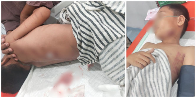 
					Zaki, anak 10 tahun yang menjadi korban serangan buaya di Desa Muara Bengalon, Kecamatan Bengalon, Kutai Timur, Minggu (9/11) malam lalu. 